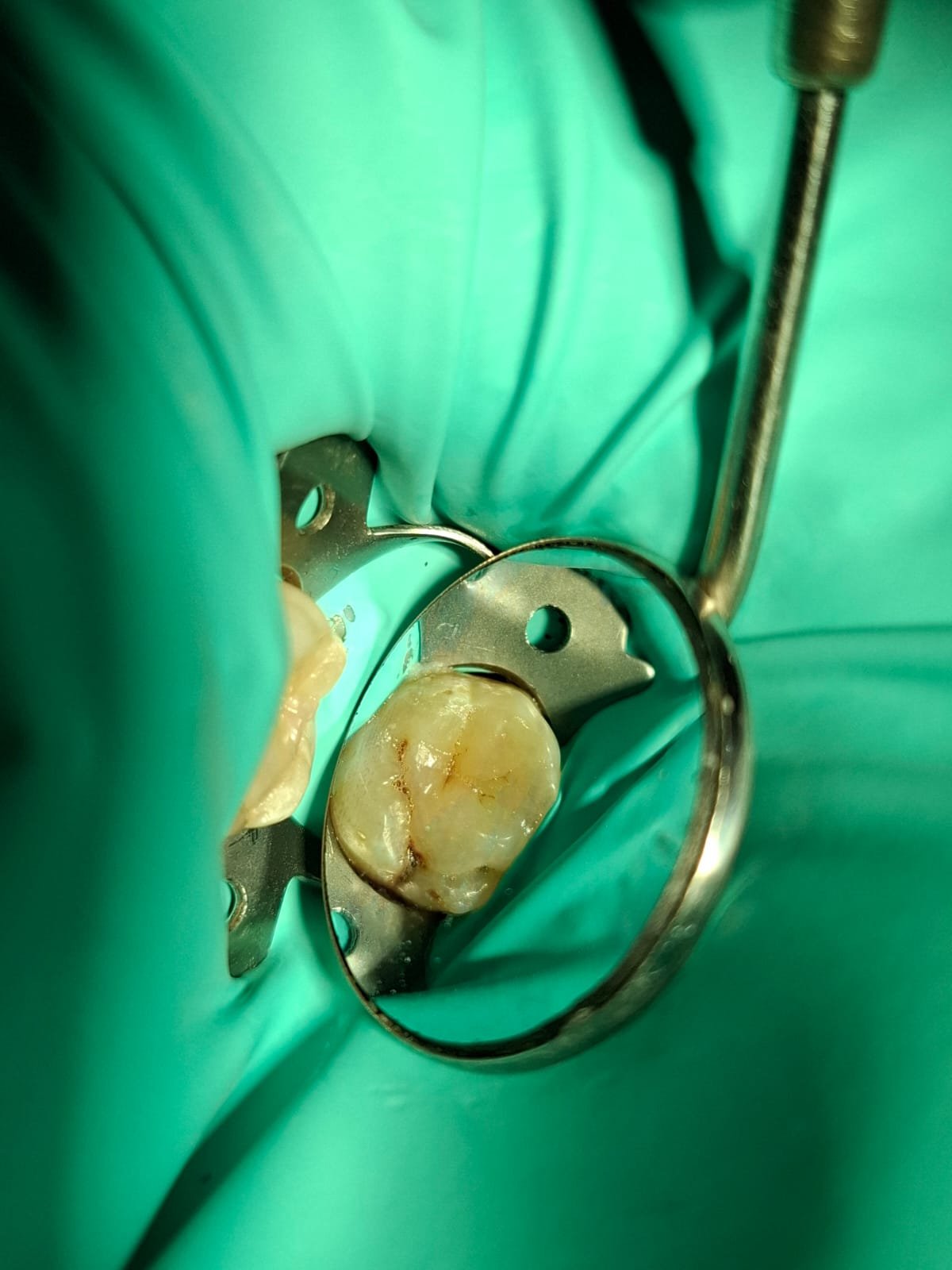 Sonrisa antes del tratamiento