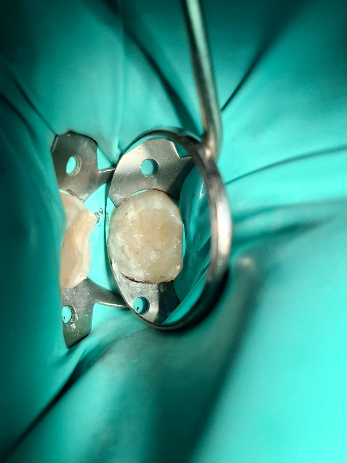 Sonrisa después del tratamiento